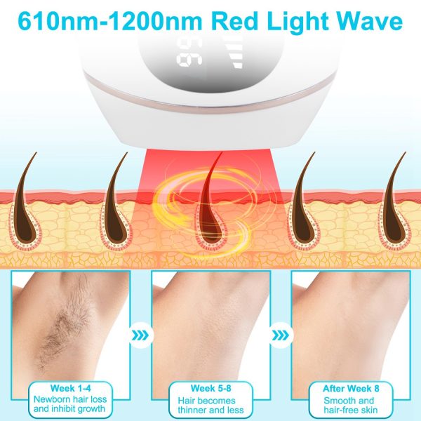 IPL Hair Removal w/ Ice-Cooling — 999,999 Flashes, 5 Levels, Auto/Manual, Face & Body - Image 7
