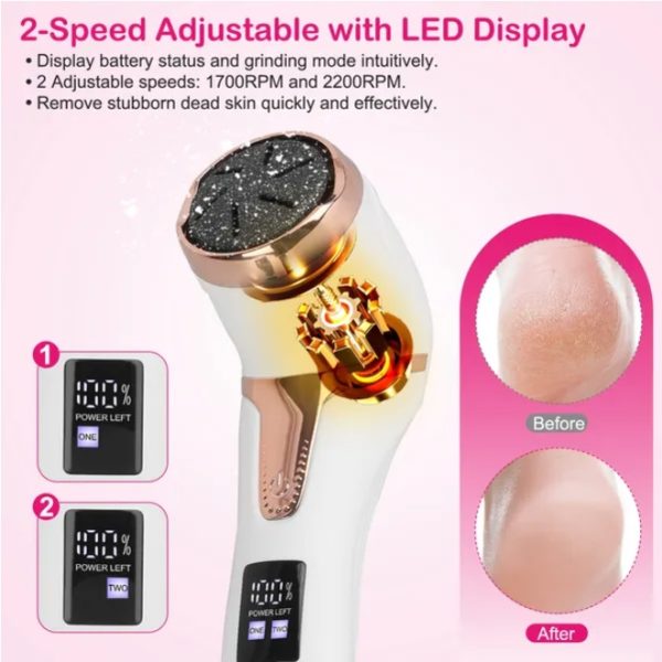 17-Piece Electric Foot Callus Remover Kit — 2-Speed LED Display, Complete Pedicure Set - Image 3